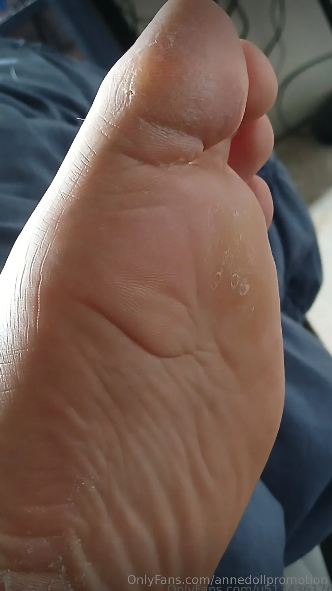 Anne Doll Promotion™