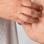 Updated List of Cancer Symptoms in 2025 -