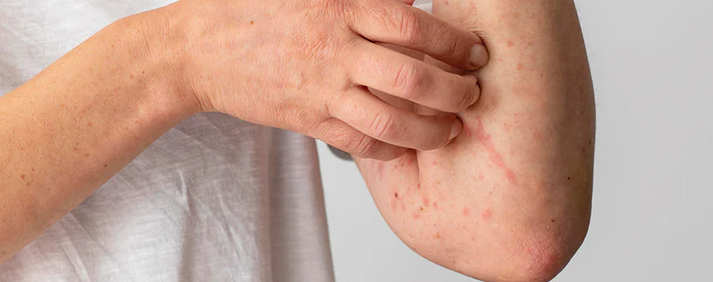 Updated List of Cancer Symptoms in 2025 -