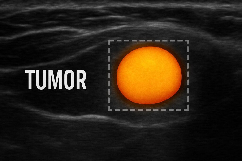 ultrasound MRI scan of neck lump diagnostic imaging