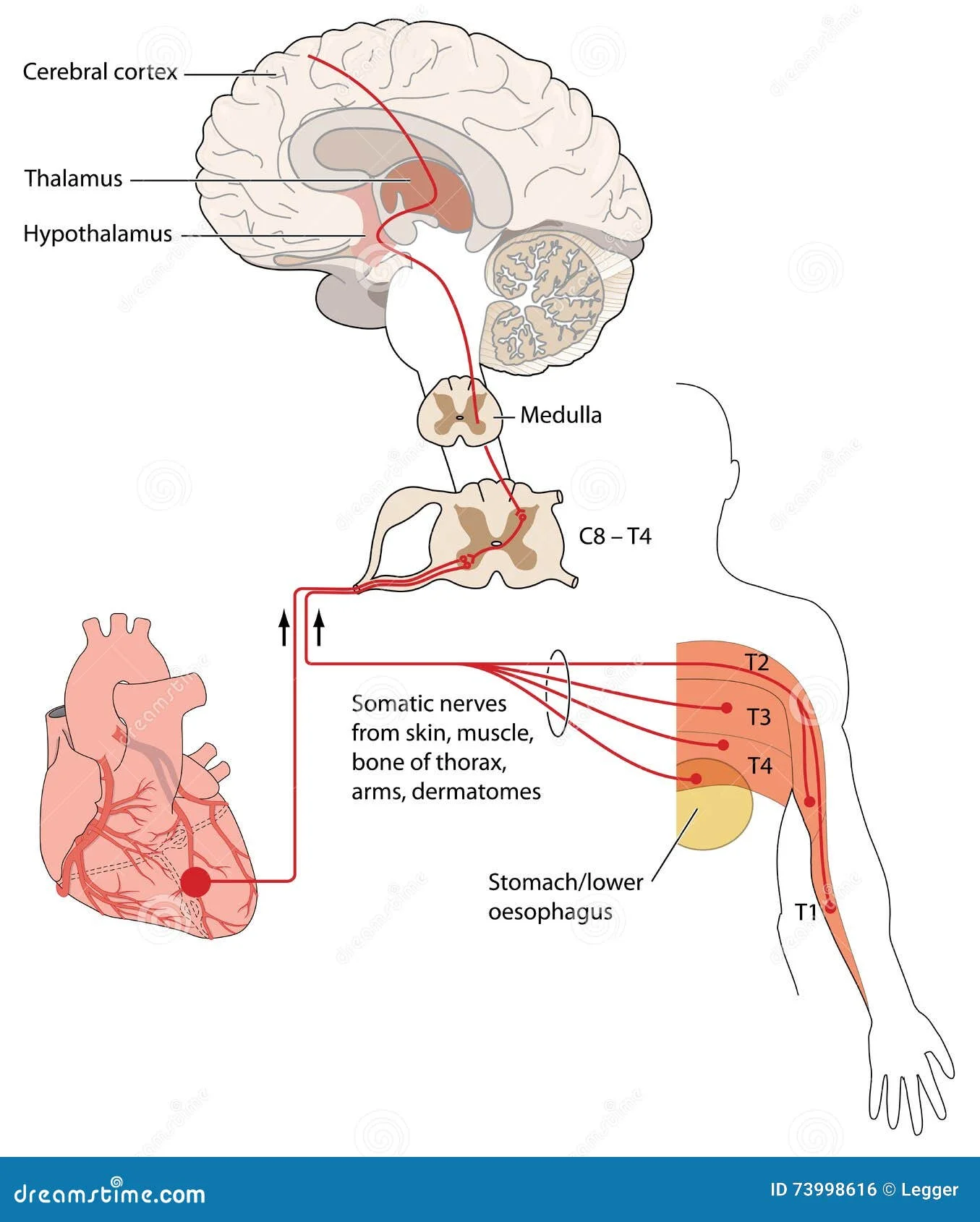 Illustration of head and neck regions showing referred pain pathways that may cause ear pain