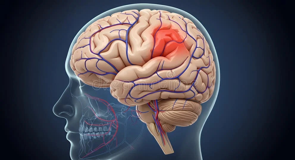Illustration showing how blood pools in the legs when standing, reducing blood flow to the brain.