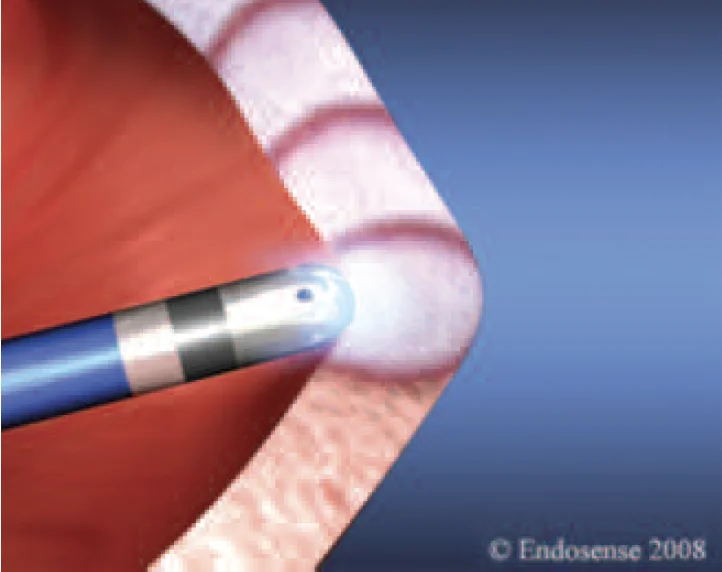 Diagram showing treatment options for irregular heartbeat, including medications, catheter ablation, and implantable devices.