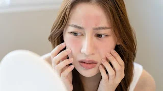 Illustration showing medical, procedural, and lifestyle strategies for managing redness on face.